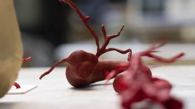 Con impresión 3D, una empresa argentina crea biomodelos para planificar cirugías y reducir riesgos