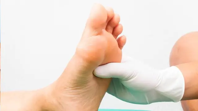 El pie diabético es una complicación frecuente de la diabetes