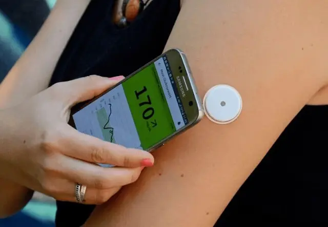 Un estudio demostró que la tecnología flash de monitoreo de glucosa mejora el control de la diabetes
