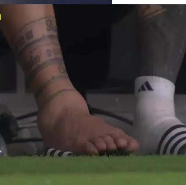 Así quedó el tobillo de Messi durante la final de la Copa América entre Argentina y Colombia