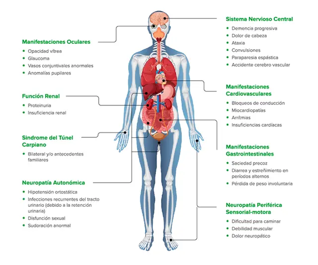 El tiempo medio al diagnóstico en Argentina es de 5 años: el principal obstáculo para diagnosticar esta patología es que sus síntomas son inespecíficos