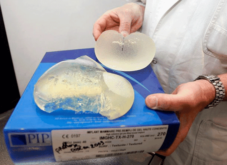 Argentinas con prótesis PIP reclamaron que el Gobierno pague su cambio de implantes