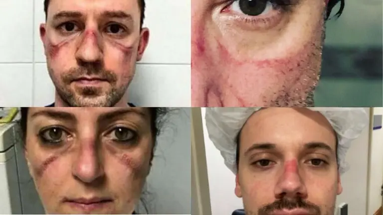 "Acá relajado, pasándola bomba": la dura respuesta del personal de salud a Fernández