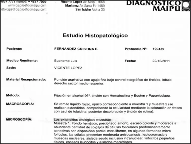 El Gobierno reveló más detalles sobre la operación de Cristina