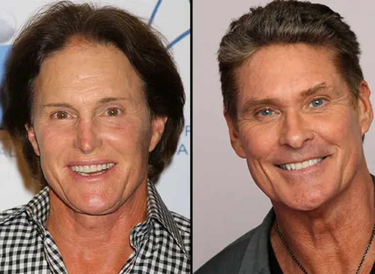 Retoques masculinos en Hollywood: el camino estético que eligieron algunos famosos