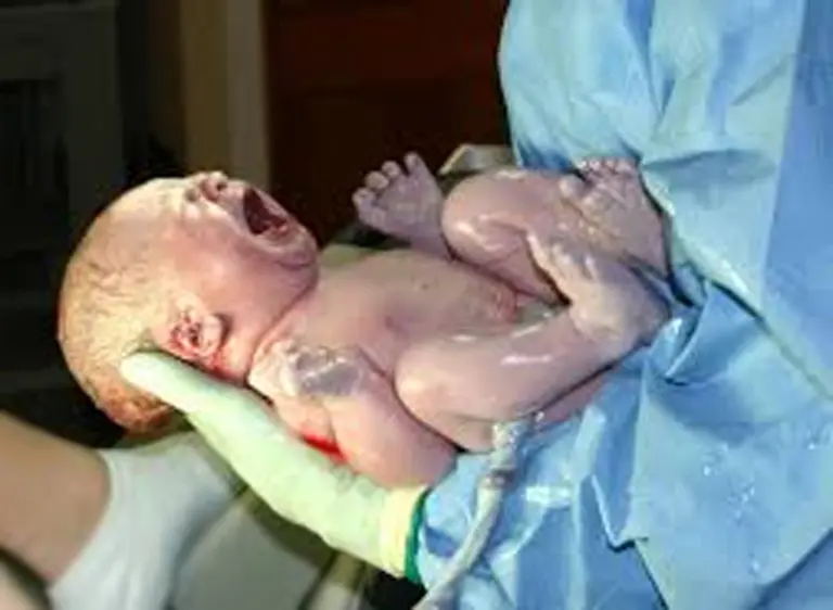 Obstetras introdujeron modificaciones a la definición de "parto a término"