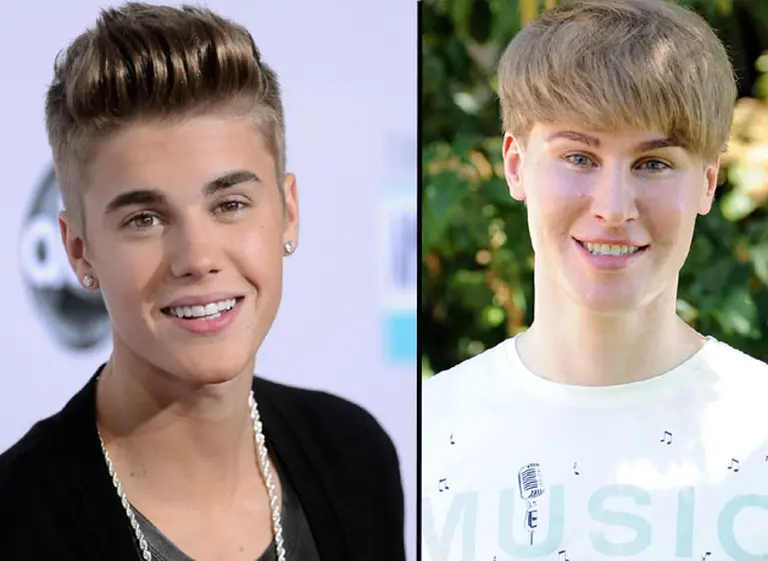 Peligrosa obsesión: fanáticos que recurrieron a cirugí­as para verse como sus í­dolos