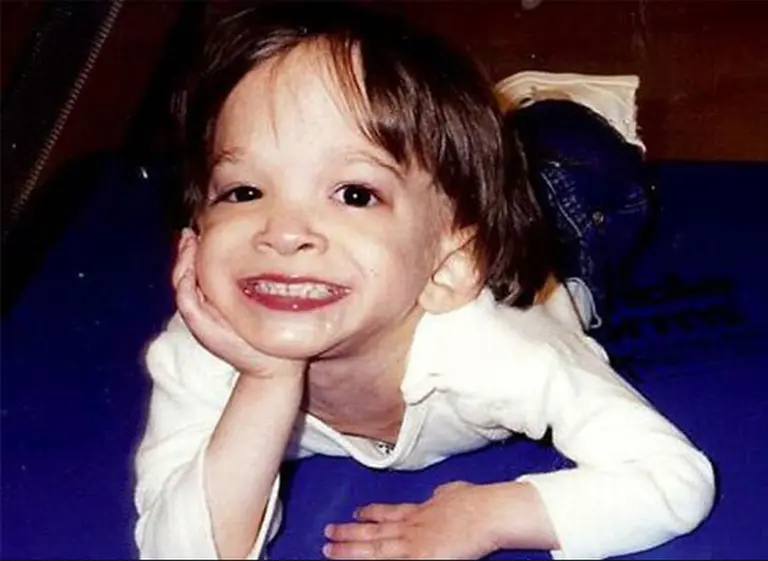 Un enigma para la ciencia: la nena que "nunca envejeció" y falleció a los 20 años