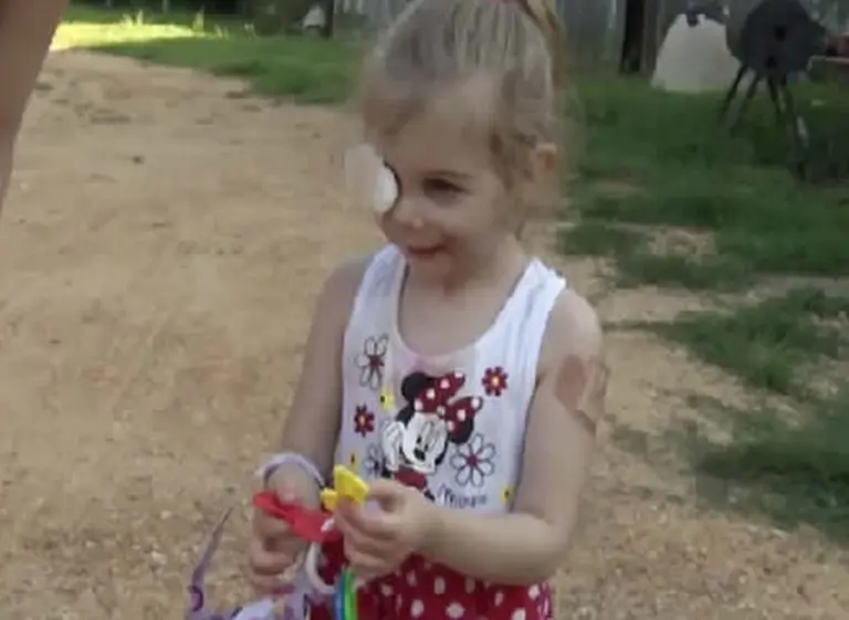 Polémico: en un local de KFC expulsan a una niña por tener cicatrices