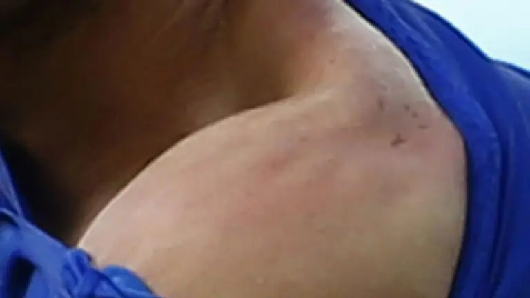 Giorgio Chiellini, el italiano mordido: "La sanción a Luis Suárez es excesiva"