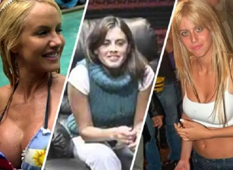 El antes y después de las famosas argentinas: cirugí­as y deformidades