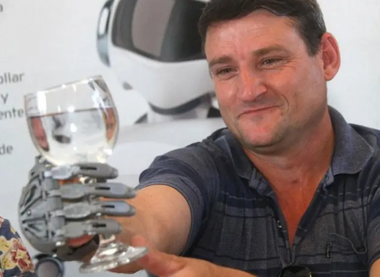 Córdoba: gracias a una prótesis fabricada con una impresora 3D, un hombre podrá volver a usar la mano