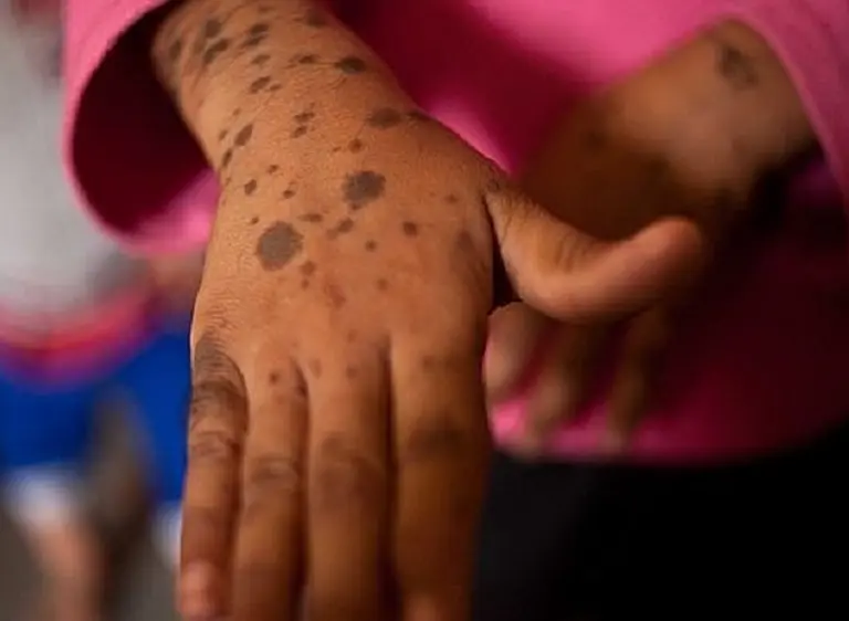 El Chaco del que no se habla: Avia Terai, un pueblo que vive envenenado por las fumigaciones