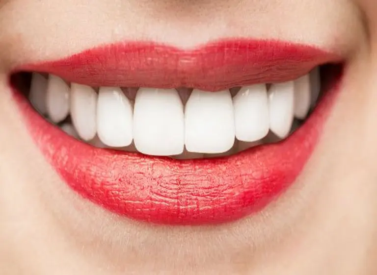 Por qué se ponen los dientes amarillos y qué hacer para evitarlo