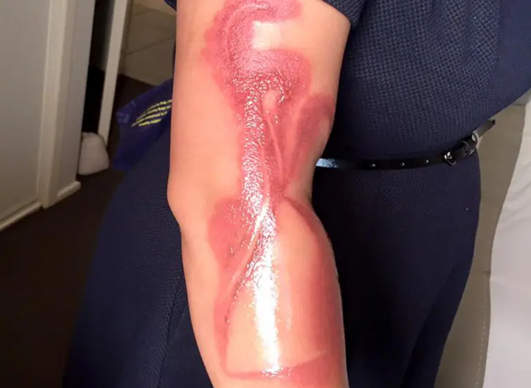 Esto le pasó a una mujer que se quedó dormida con su iPhone 7 enchufado