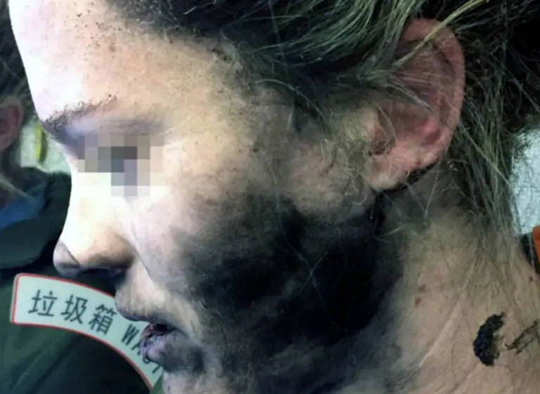 ¿Cuán probable es que exploten los audí­fonos?