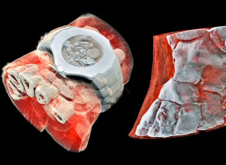 Su próxima radiografí­a podrí­a ser en colores