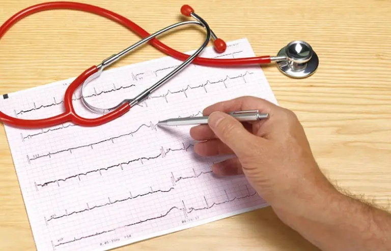 Palpitaciones: una sensación que puede ser inofensiva o requerir una intervención quirúrgica