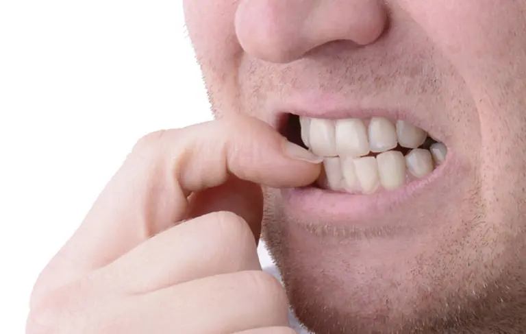 Las consecuencias que puede ocasionar morderse las uñas constantemente