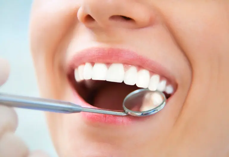 El blanqueamiento dental, ¿tiene efectos secundarios?