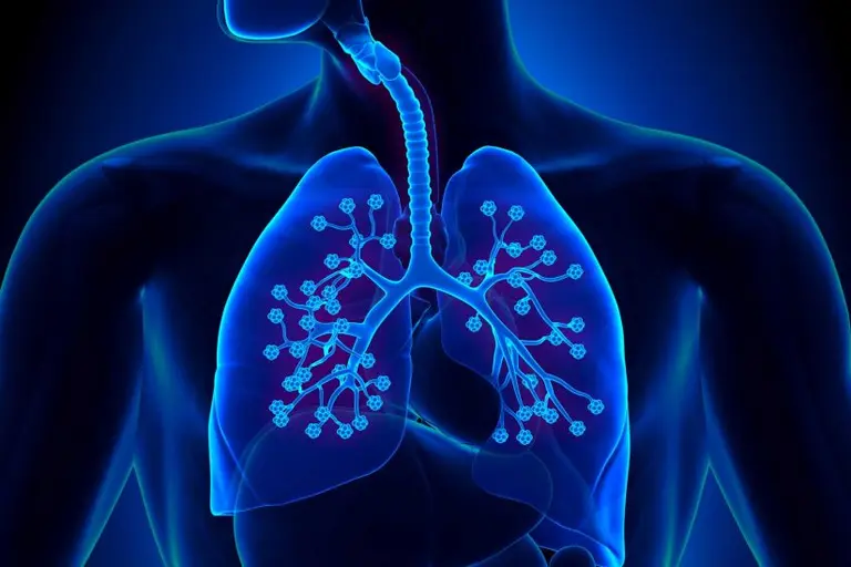 ¿Hipertensión pulmonar?: qué es y cuáles son los síntomas de una enfermedad de difícil diagnóstico