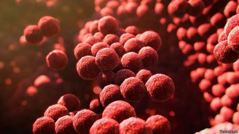 ¿Qué es el síndrome de shock tóxico y cómo puede afectar a las mujeres?