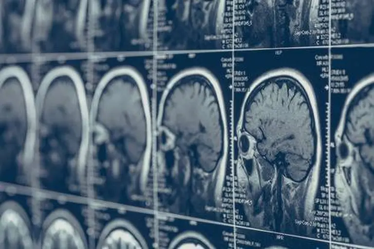 ¿Podría existir una vacuna personalizada para mejorar la supervivencia en ciertos tipos de cáncer?