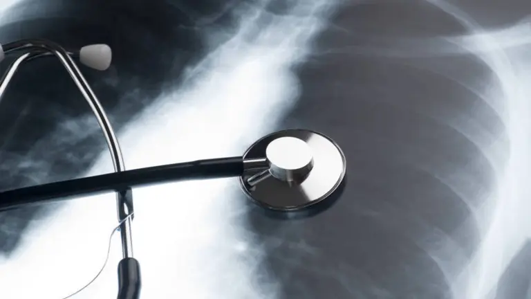 No siempre duele el pecho, ¿cuándo la falta de aire indica problemas cardíacos?