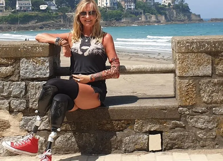 Tenía tos, fue al hospital y le hicieron una amputación cuádruple