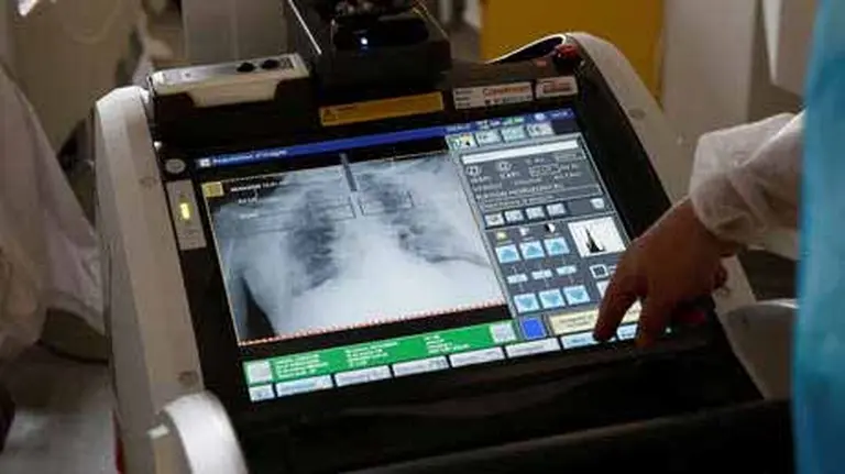 ¿Diagnóstico de coronavirus en un minuto por inteligencia artificial?: avanzan desarrollos para aplicarlo en Argentina