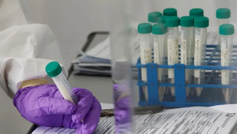 ¿Potente inhibidor del coronavirus? El medicamento que podría ser ideal para el tratamiento