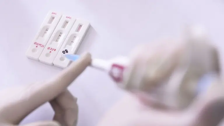 "Tenemos que aprender lo más rápido posible a convivir con el virus"