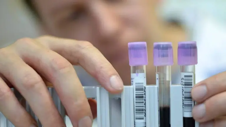 El tipo sanguíneo podría incrementar o disminuir el riesgo de padecer Covid-19