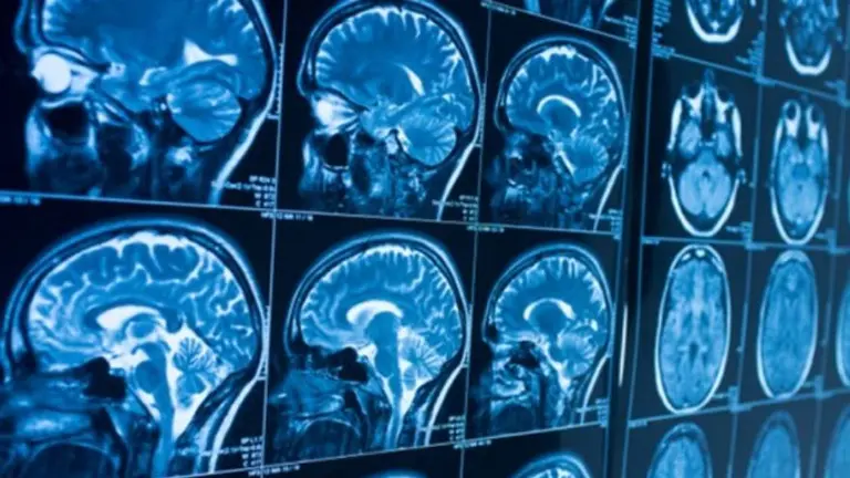 Científicos argentinos crearon un asistente virtual móvil para reconocer síntomas de ACV