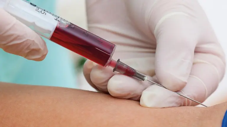 ¿Te desmayás cuando ves sangre?: estos trucos te van a ayudar a evitarlo