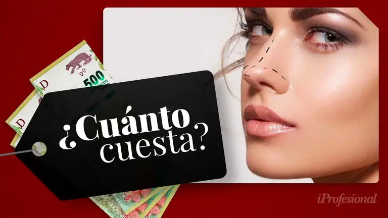 Cuánto cuesta una rinoplastia en Argentina en 2021