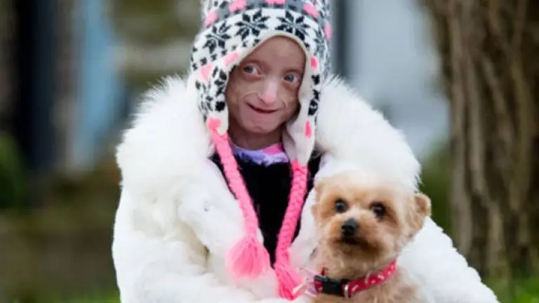 La "Benjamin Button" británica: una chica falleció a los 18 años en el cuerpo de una anciana