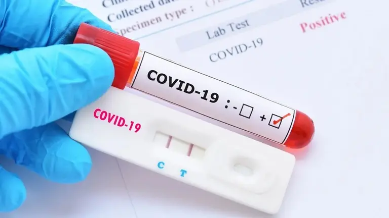 Primer llamado a la acción sobre el uso de pruebas serológicas en las estrategias de vacunación contra COVID-19