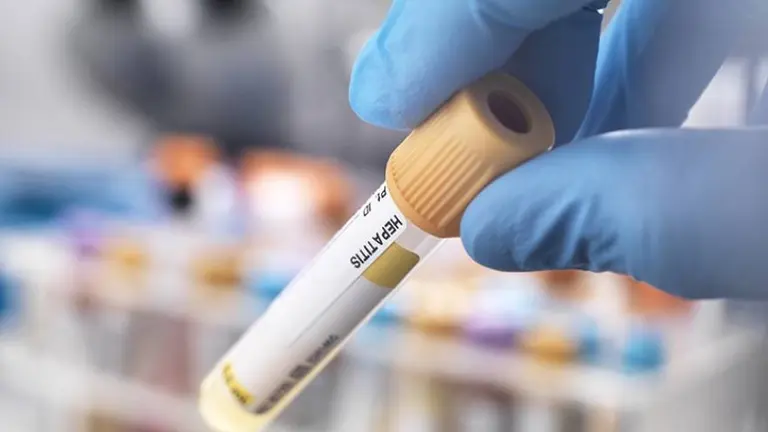 Hepatitis desconocida y viruela del mono: ¿surgen más enfermedades raras o sólo las detectamos?