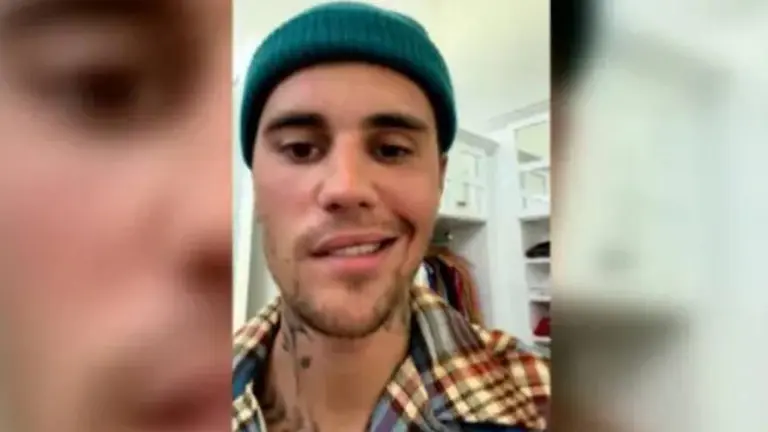 Qué otras consecuencias puede traer la enfermedad que padece Justin Bieber