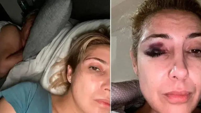 Se conocieron nuevas fotos de Fabiola Yañez golpeada