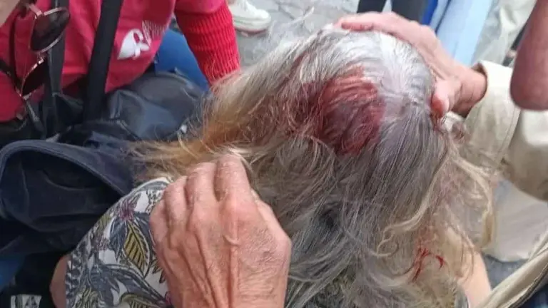 La hija de la jubilada agredida pide que la Justicia "tome medidas para que la gente pueda expresarse libremente"