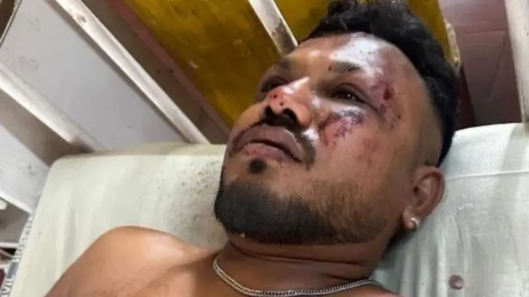 VIDEO | Así salió caminando el único sobreviviente del avión que se estrelló en India: "Había cuerpos por todos lados"