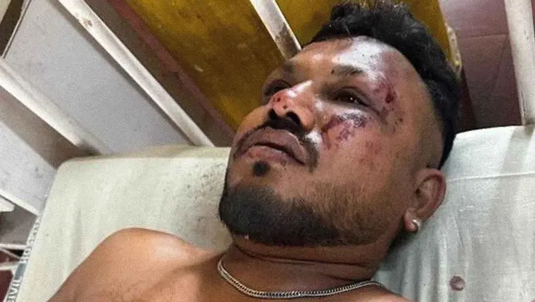 "Pensé que iba a morir": el estremecedor relato del único sobreviviente del vuelo AI-171