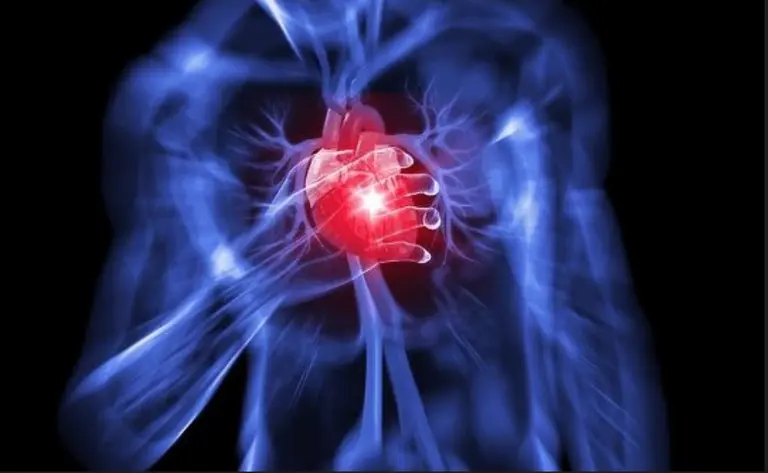 Las probabilidades que existen de sufrir un infarto si ya tuve uno