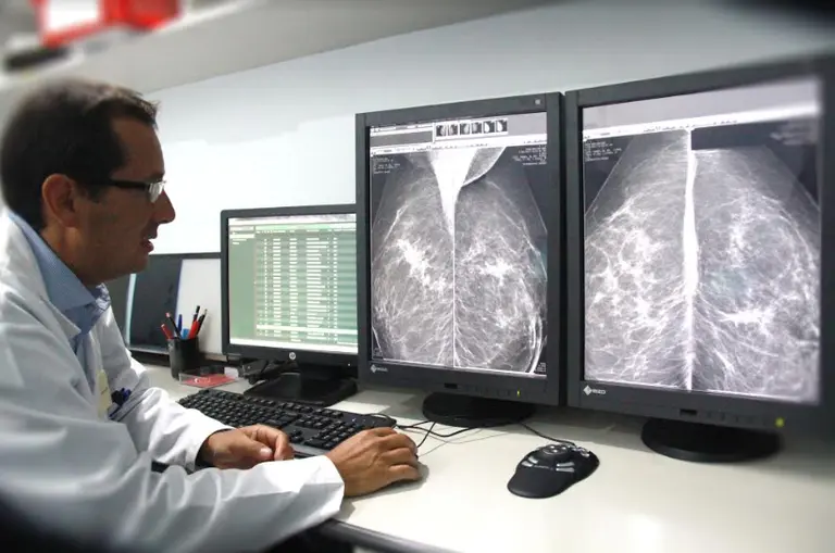 Cáncer de mama: un nuevo estudio puede aumentar su detección hasta en un 45%