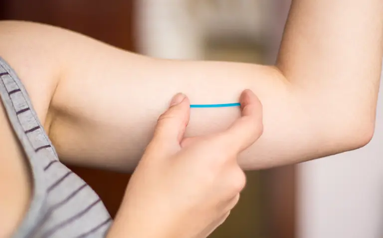 Las jóvenes argentinas tienen alta preferencia por el implante subdérmico como anticonceptivo