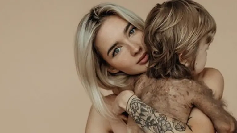 Pedido desesperado: una instagramer rusa hizo pública la extraña enfermedad que sufre su hijo para recaudar fondos