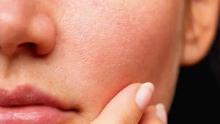 Estos son los efectos que produce el estrés crónico en la piel