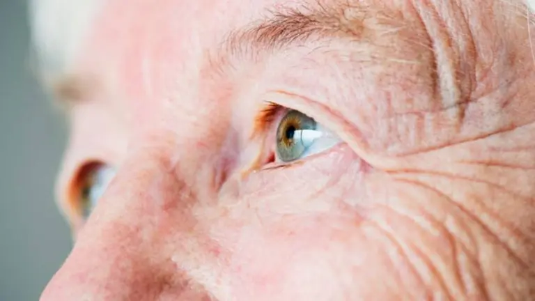 Mucho más que arrugas: cómo envejece el rostro con el paso del tiempo